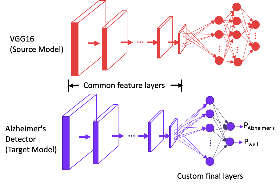 Alzheimer’s detection using transfer learning