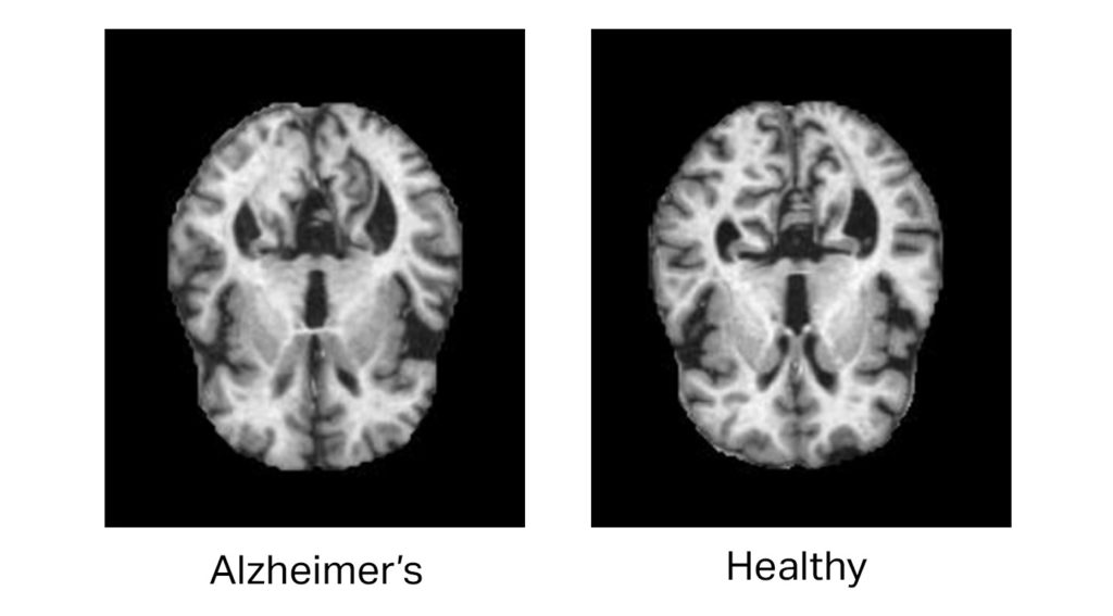 Why Healthcare Data is a Minefield for AI Research